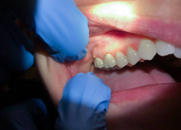 Best Emergency Dentist for Knocked-Out Tooth in Walnut Ridge, AR